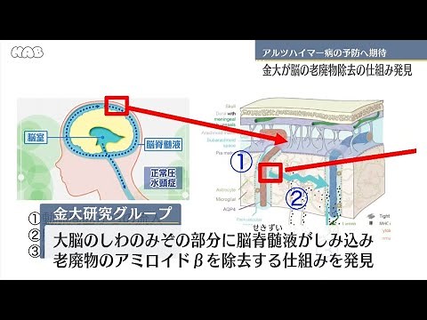 Brain wrinkles remove waste products, discovered by Kanazawa University group.