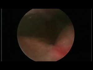 Cystoscopy in a normal female dog