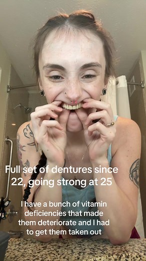 If I didn’t tell you you’d never know🤣😉 it’s been a long journey but I’m doing great with them! Had them since I was 22, I’ll be 26 in a few months and they make me feel so beautiful and like myself again🫶🏻if you’re a young person with dentures YOU ARE NOT ALONE! I’m here if anyone needs advice or to talk❤️#denturesatayoungage #dentures #denturesmile #fyp #nighttimeroutine