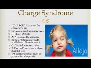 CHARGE Syndrome ; Definition, Causes, Symptoms, Diagnosis, Treatment