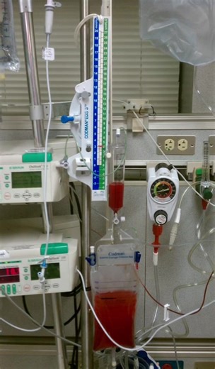 Evd external ventricular drain #nursing #neurology #تمريض #foryoupage #fyp