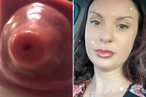 Midwife’s video showing how big a woman’s cervix gets giving birth goes viral