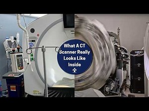 World’s Fastest CT Scanner Spinning at Maximum Speed