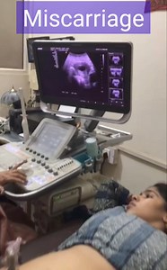 132K views · 231 reactions | Miscarriage is very common in early pregnancy, there are so many factors responsible for missed abortion..... #miscarriage #silentmiscarriage #missedabortion #pregnancylife | Dr home - Dr shikha Agarwal | Facebook