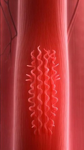 What Happens During Muscle Cramps? | The Science Behind Sudden Muscle Pain (3D Animation)