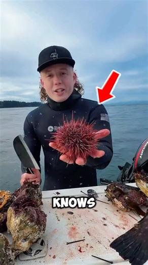 🔬😱 What's Inside a Sea Urchin? Microscopic View Will SHOCK You! 🐙🌊