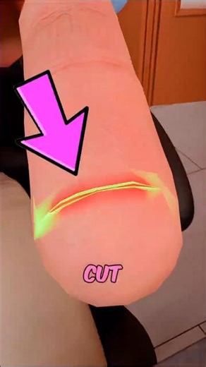 Why Paper Cuts Hurt MORE Than You Think😱