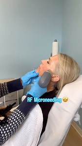 Pixel-8 RF Microneedling treatment is a revolutionary treatment meant to stimulate the production of collagen. It dramatically increases skin tightness and vitality | Laser Loft