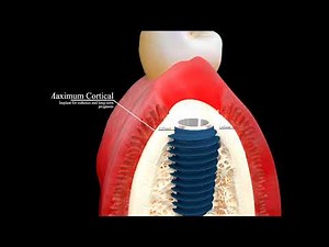 AnyRidge from MegaGen