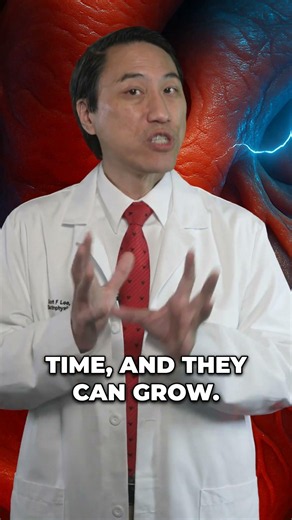 Why AFib Isn’t Random (And What It’s Doing to Your Heart)