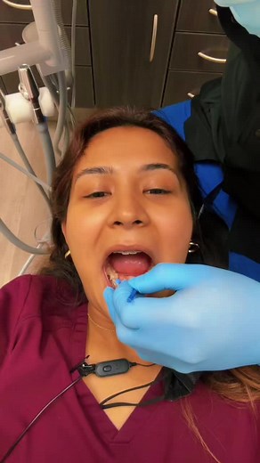 Exploring Bite Blocks for Braces: A Comprehensive Guide