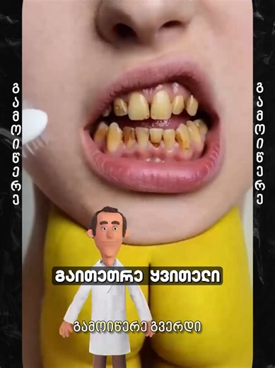 გაითეთრე კბილები სახლში 🦷✨ სულ რამდენიმე წუთში — მარტივი ინგრედიენტებით. თუ გინდა უფრო ნათელი ღიმილი, ნაკლები სიყვითლე და სუფთა სუნთქვა ეს ვიდეო აუცილებლად შეინახე 📌 👉 შედეგი პირველივე გამოყენებიდან ჩანს 👉 მარტივი, ხელმისაწვდომი მეთოდი 👉 რეგულარული მოვლა = მბზინავი ღიმილი დააკომენტარე „ჯაგრისი“ 🪥 და მიიღე ჩემი უფასო გზამკვლევი კბილების სწორ მოვლაზე 📘