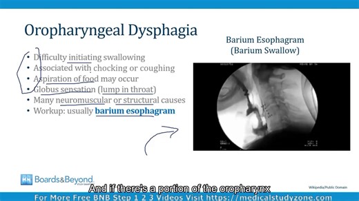 [胃肠病学|食道疾病与吞咽困难⭐]-[Gastroenterology|Esophageal Disorders]-(BNB Step2/3|070)