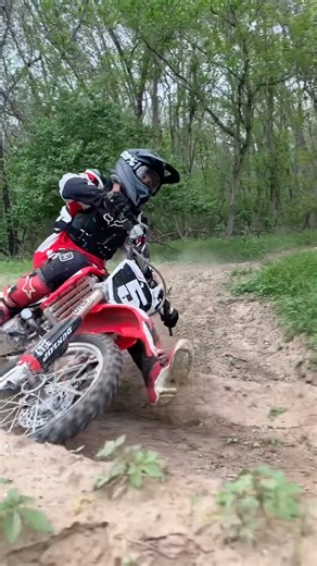 Laying down the 150R