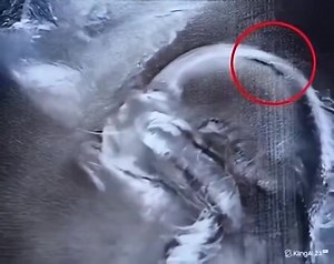 “The Doctor Looked at the Ultrasound… and Froze 😳” | IPHONE DOCTOR,z 18