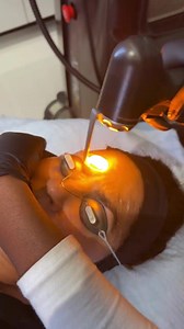 Jason Emer, MD on Instagram: "🔦Advalight in 3,2,1🔦 Our patient had some spots on her face that she wanted to get rid of and what better way then treating them with our advatx. She heard about us from her sister that had gotten the treatments and loved her results and she wanted to give it a try"