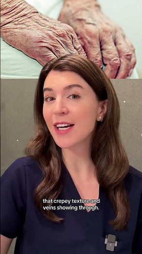 Do your hands show your age? Here's what to do