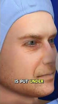 🧬 How Bone Marrow Is Donated: 3D Animation Explained #BoneMarrow #StemCells #3danimation