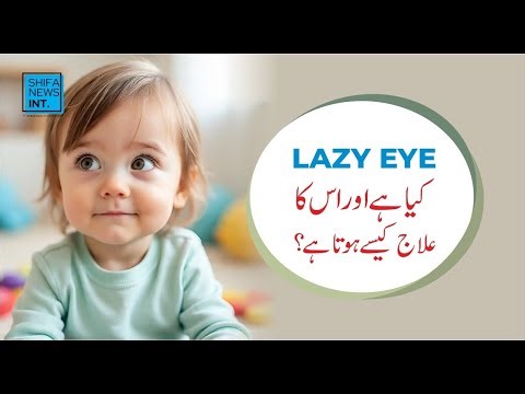 Lazy eye (Amblyopia) explained | Shifa News