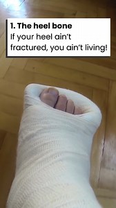 When we fracture these five bones, you won’t hear us complaining! Here are our personal favorite bones to fracture again and again! | ClickHole