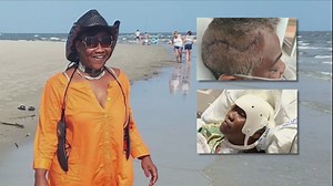 Sword attack victim partially paralyzed; family asking for support