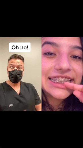 How to Fix a Broken Bracket on Braces: Easy Solutions