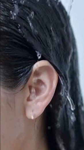 Nizoral Anti-Dandruff Shampoo