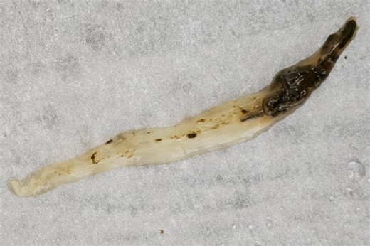 MS and Flukes: Why This Parasite Appears in Almost Every Chronic Disease - Live Disease Free
