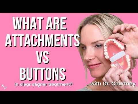CLEAR ALIGNER ATTACHMENTS, BUTTONS, AND RUBBER BANDS EXPLAINED | NYC Orthodontist at Smile Pop