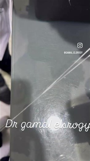 Using Dental Floss for Rubber Dam Stabilization | Dental Floss Tie Technique