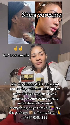 It’s a new day week with good reviews of my clients on different products! Here is my swt loving client from Denmark 🇩🇰 she uses my vip package 📦 See results of 2 months and some days👌 isn’t dis beautiful 🤷‍♀️ 0783030222 watsup We deliver our products in all countries 🌎✈️✈️ | Sherry Matovu