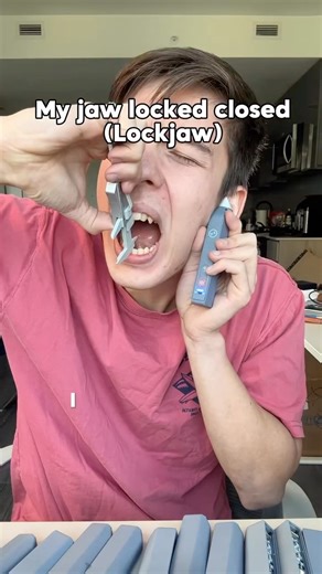 myTMJrelief on Instagram: "UPDATE 👇 Ok so I uploaded this video like a month ago. For some reason its audio got deleted, but whatever. Since then there have been some updates. So basically one time I tried doing this again, and when I’d push the jaw up into the disc to try to drag it back - there was no pop. But I could also tell the disc was still displaced, which tells me this time I wasn’t even able to recapture it when opening that wide. Unfortunately I think it means we’re cooked, and it’s