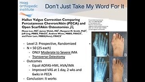 The Future Is Now: Minimally Invasive Bunion Surgery Is Here to Stay