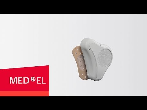 Applying the ADHEAR System | MED-EL