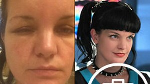 Pauley Perrette hospitalisée et défigurée après une grave allergie (PHOTOS) - Télé-Loisirs