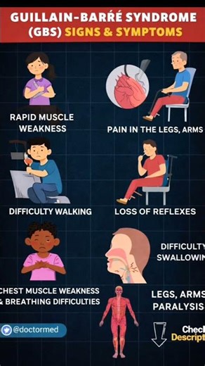 Can't Walk? The Silent Warning Signs of GBS