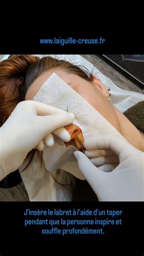 Procédure de nostril in/out