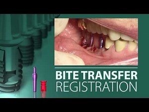 Implant Level Impression and Bite Registration