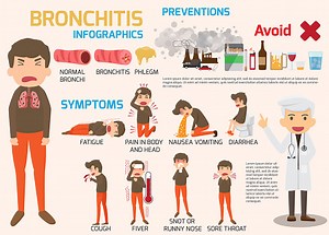 Bronchitis Krankheit Symptome und Behandlung Infografiken....
