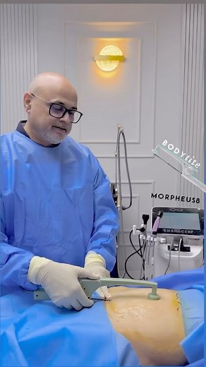 1.1K views | BodyTite at Dr Haroon Nabi’s clinic in Lahore. @haroon_nabi @inmode.international @inmodeaesthetics @aestheticlifepakistan | Academy of Aesthetics | Facebook