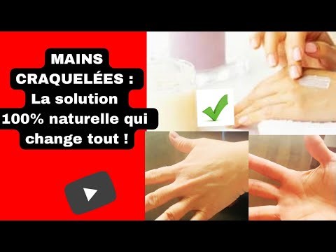 Mains sèches et craquelées:Comment les réparer intensément avec le beurre de Karité