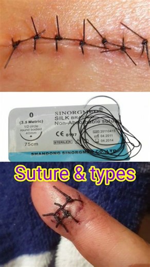 #suturing #sutures #silk #vicryl #monocryl #medical #nursing #doctor #nursingknowledge #hospital