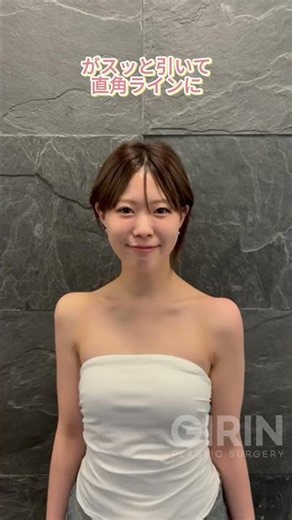 肩の丸みが自然に整って、理想の直角肩に✨埋もれていた鎖骨もふわっと出て、首が長く見えるラインに🤍