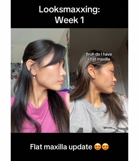 Maxilla Looksmaxing: Week 1 Update