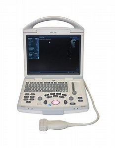 [Hot Item] Mindray Ultrasound Scanner, Machine Dp-20 with Probes