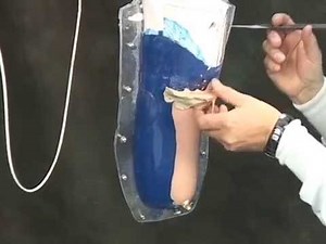 Custom Fabrication of Injection Molded Silicone Liners