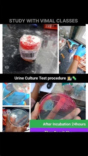 Urine Culture Test procedure 🧑‍🔬 Identify Causing UTI Infection #labtechnicians #shorts