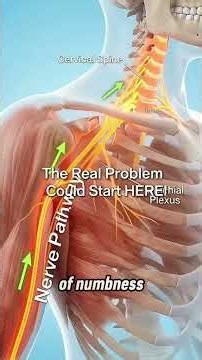 Numb Fingers: Beyond Carpal Tunnel Syndrome