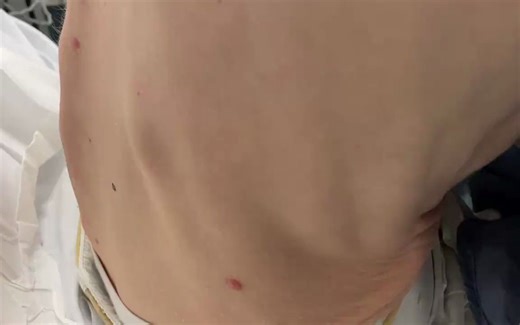 Hoover's sign 胡佛征