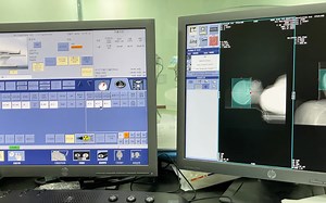 快速脑卒中 CTP联合扫描培训